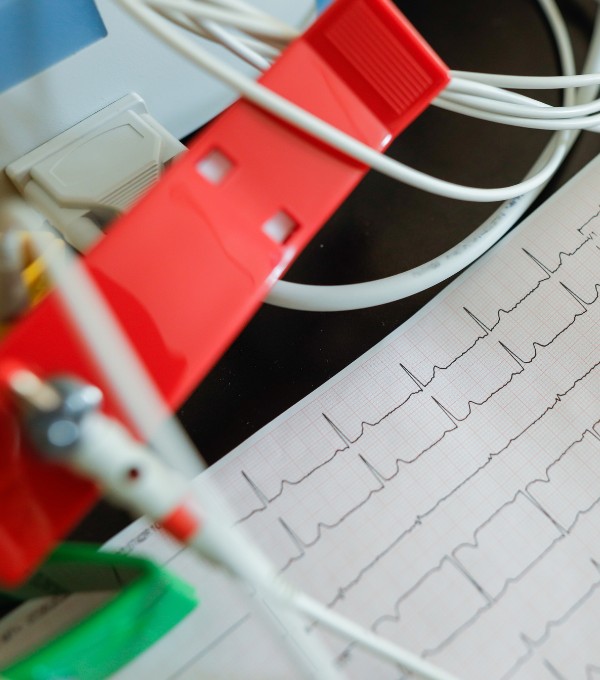 Electrocardiograma (ECG)